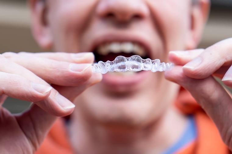 The Benefits Of Invisalign For Adults