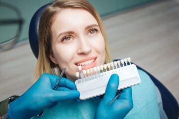 Composite Veneers