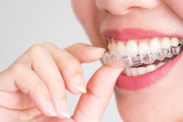 Invisalign