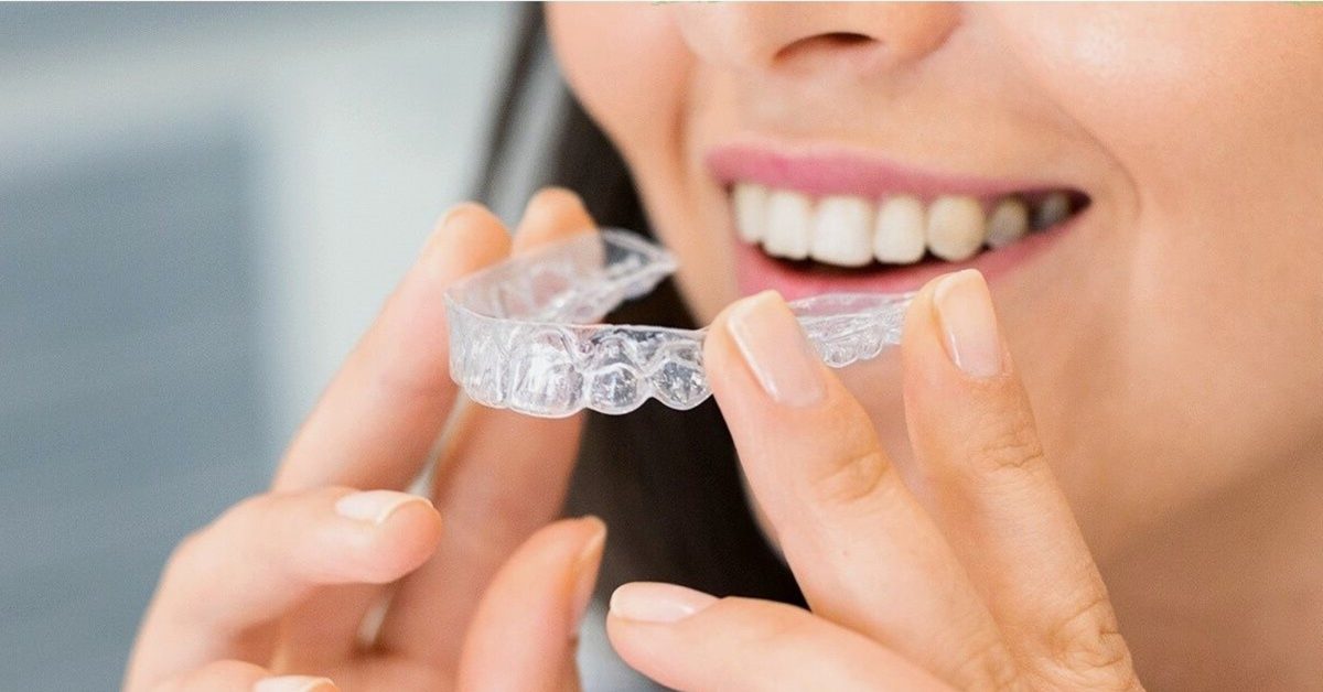 Invisalign