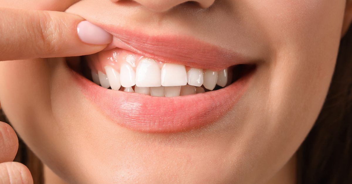 gum health