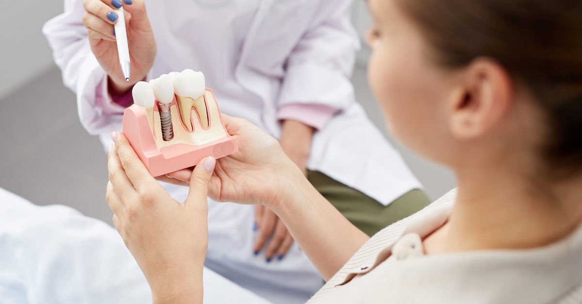 post dental implants