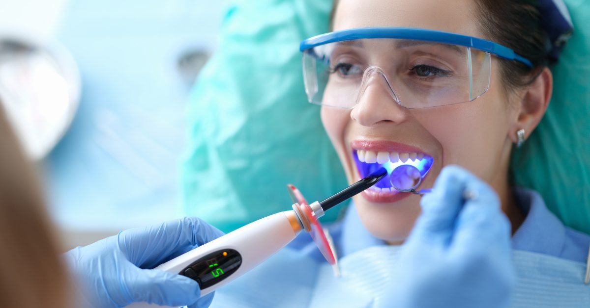Composite Bonding