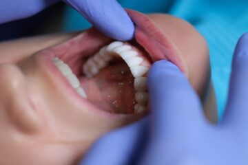 composite bonding