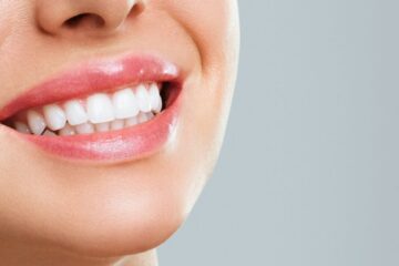 Teeth Whitening