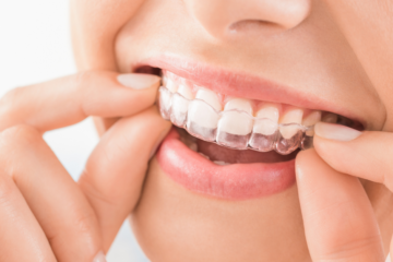Invisalign