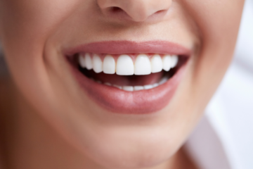 Stopping Invisalign