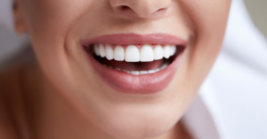 woman smiling after invisalign treatment