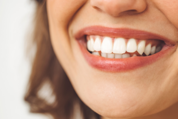Gummy Smiles