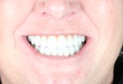 IMG_0303